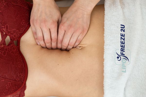 diastasis recti treatment Harefield
