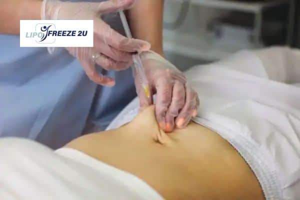 How Does Aqualyx Fat Dissolving Injection Work to Break Down Fat Harefield?