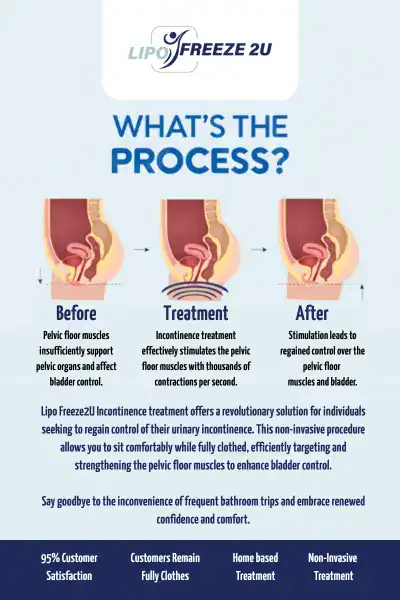 Diagram of how incontinence treatment Harefield works.