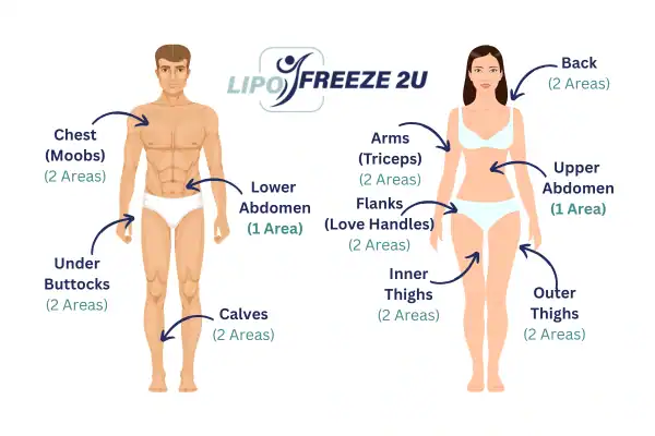 Areas you can have fat freezing treatment Harefield