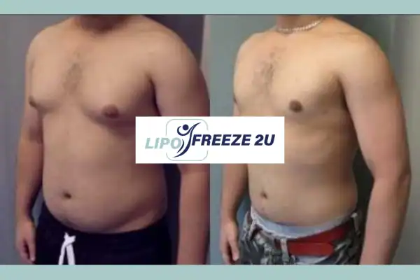 How Long Does It Take to See Results Harefield?