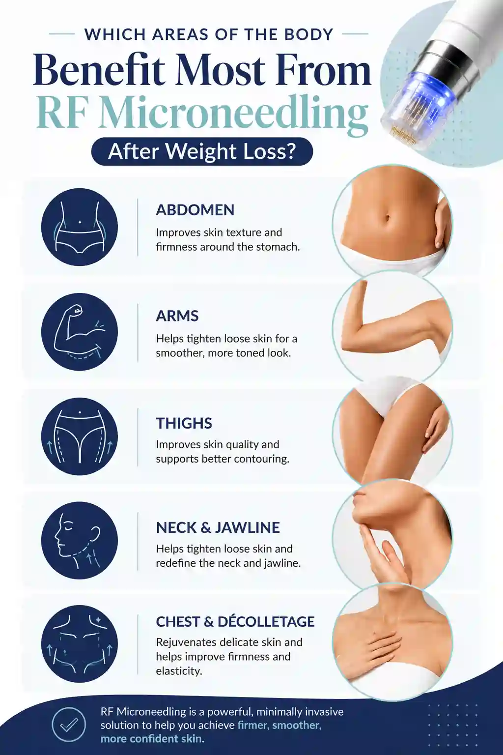 Which Areas of the Body Benefit Most From RF Microneedling After Weight Loss Harefield